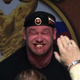 Illustration for article titled Strongmans Face Starts Gushing Blood During Deadliftem/em